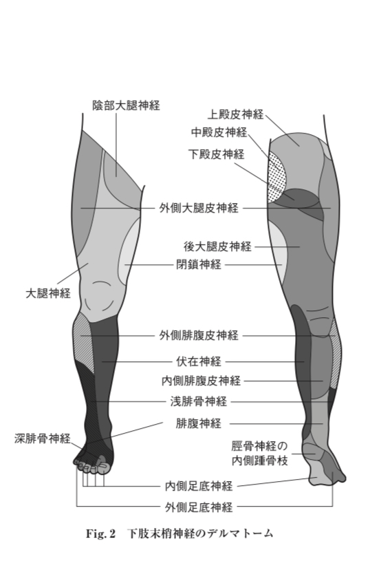 大腿外側の痛みやしびれ｜サンシャイン通り接骨院｜池袋の腰痛・肩こりケア